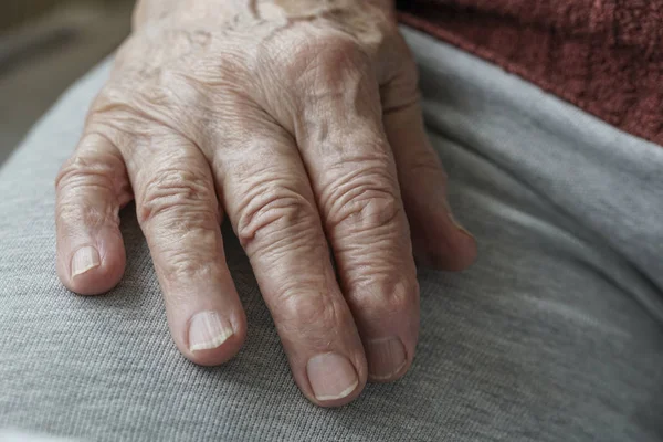 Морщинистая рука пожилого человека — стоковое фото