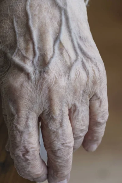 Nahaufnahme Faltige Hand Eines Älteren Menschen — Stockfoto