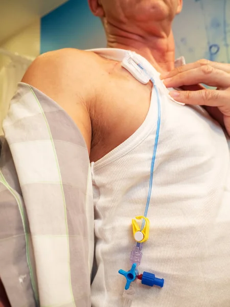 C için implante edilebilir bağlantı noktasına intravenöz sıvı enjeksiyon için tüp — Stok fotoğraf