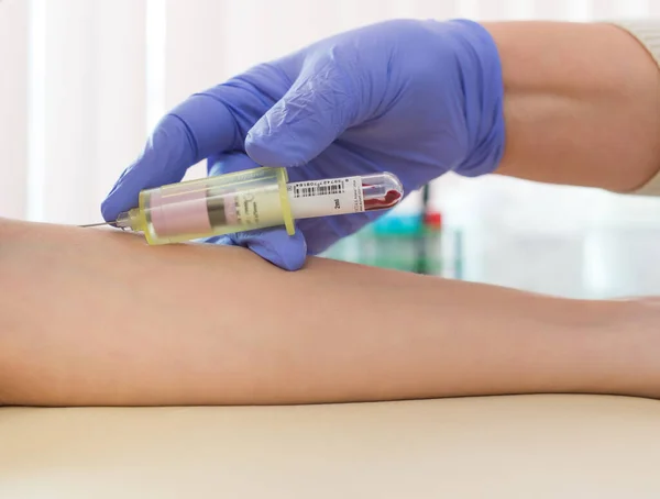 Damardan kan örneği alınıyor.