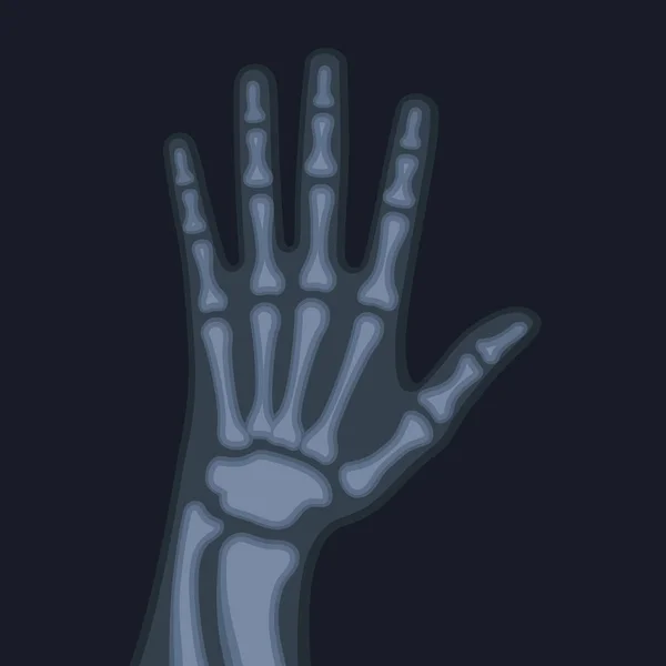 X Rays Style Human Hand. Vector — Stock Vector