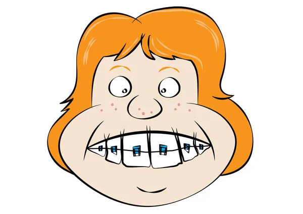 Зубные косметические брекеты — стоковый вектор