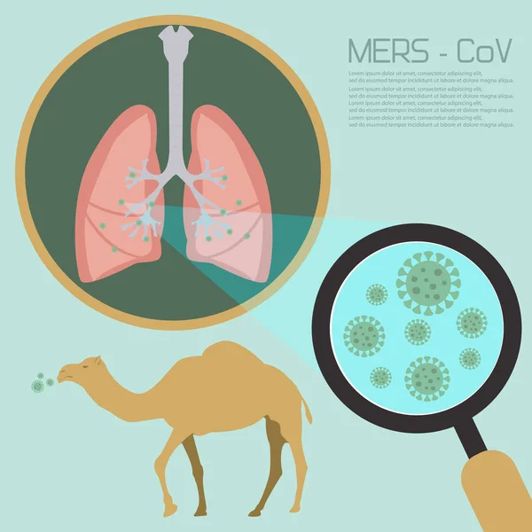 Síndrome respiratorio de Oriente Medio — Vector de stock