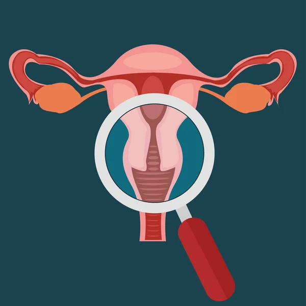 Concetto di ispezione ovarica — Vettoriale Stock