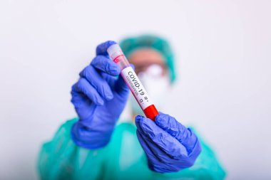 Coronavirus 2019 nCoV kan örneği. Yeni Salgın Corona Virüsü. Corona virüsü salgını. Laboratuvardaki Corona Virüsü. Bilim adamları, Coronavirüs virüslü kan testi ile tüpü tutuyorlar. Aşı