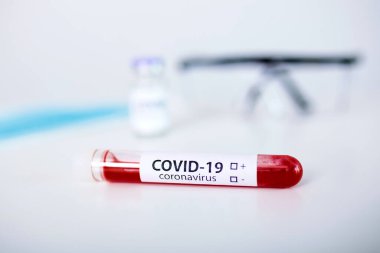 Wuhan 'dan yeni Corona virüsü enfeksiyonu (yeni Corona virüsü 2019) tanısı için pozitif COVID-19 testi ve laboratuvar örneği. Bulaşıcı salgın konsepti
