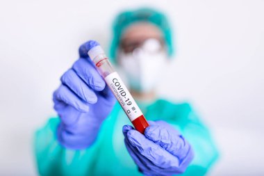 Coronavirus 2019 nCoV kan örneği. Yeni Salgın Corona Virüsü. Corona virüsü salgını. Laboratuvardaki Corona Virüsü. Bilim adamları, Coronavirüs virüslü kan testi ile tüpü tutuyorlar. Aşı