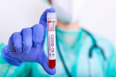 Virüs için kan örnekleri test ediliyor: Epidemiyoloji uzmanı koronavirüs için kan testi yaptırıyor. Salgın Koronavirüs 2019-nCoV, COVID-19