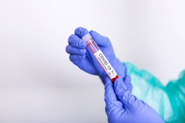 COVID-19 virüsü için hızlı test cihazı kullanarak pozitif test sonucu, yeni Coronavirus 2019. Coronavirus Covid 19, doktorun biyolojik tehlike korumasının elinde bulunan örnek tüpten kan örneği aldı.