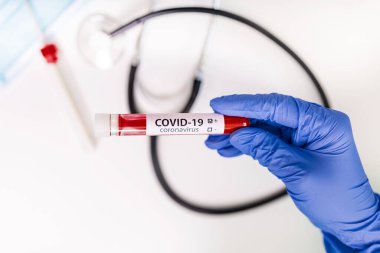 Coronavirus 2019 nCoV kan örneği. Yeni Salgın Corona Virüsü. Corona virüsü salgını. Laboratuvardaki Corona Virüsü. Bilim adamları, Coronavirüs virüslü kan testi ile tüpü tutuyorlar. Aşı