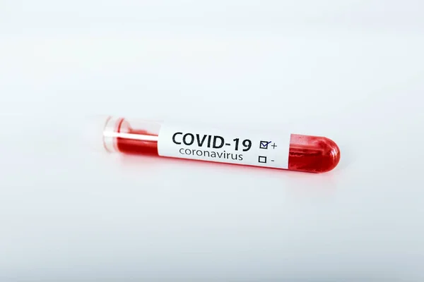 Tubo Ensayo Con Muestra Sangre Para Prueba Covid Nuevo Coronavirus —  Fotos de Stock