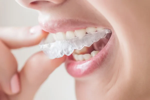 Sorrindo Mulher com treinador de silicone de perto . — Fotografia de Stock