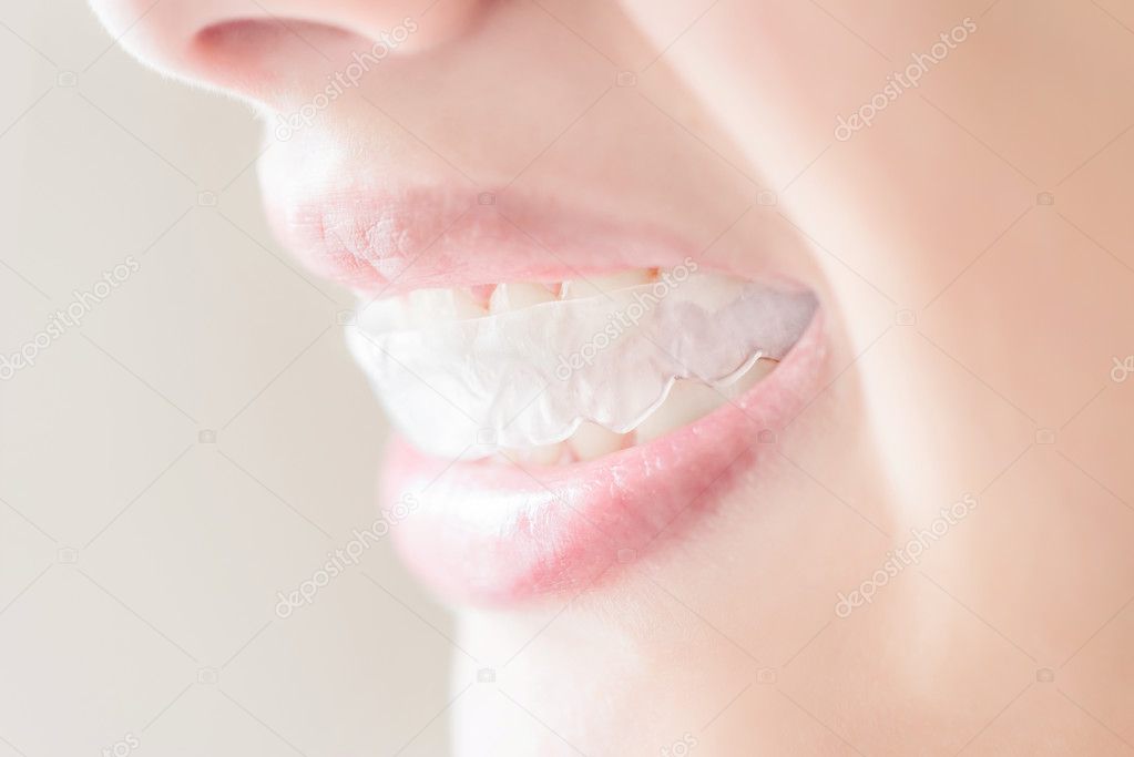 Smiling woman with silicone trainer close up.