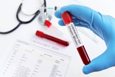 Coronavirus testi. Doktorun eldiveni içinde Coronavirus pozitif kan taşıyan bir test tüpü.. 