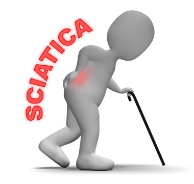 Sciatica Pain Indicates Vertebral Column Problem 3d Rendering clipart