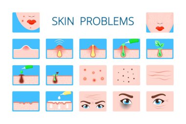 Deri sorunu. Hijyen bilgisi hasarlı cilt koyu halkaları enfeksiyonla, kırışıklıklarla, tıkanmış gözeneklerle, vektörlerle karşı karşıya.