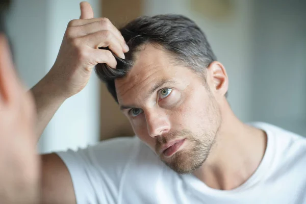 Retrato Hombre Preocupado Por Pérdida Cabello — Foto de Stock