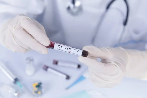 Covid 19コロナウイルス検査血液を保持保護手袋と医師の手 ウイルス検査と研究の概念 — ストック写真