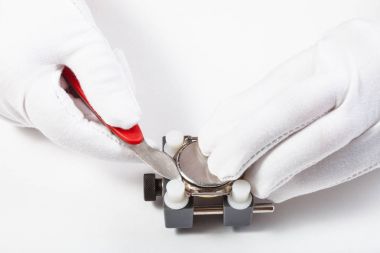 watch keskin açacağı tarafından açılış arka kapaðýný