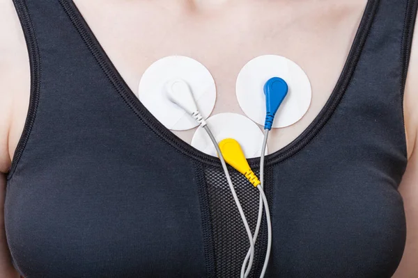 Electrodes of Holter monitor are attached to chest — Stock Photo, Image