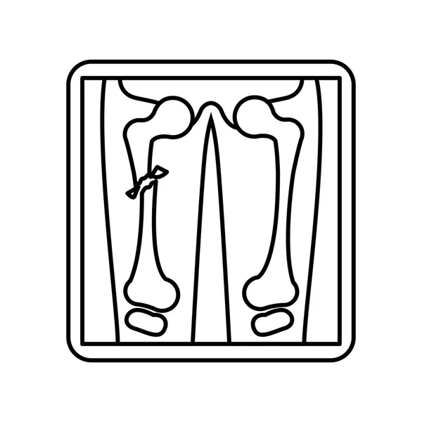 Силуэт экрана с рентгеном костей — стоковый вектор