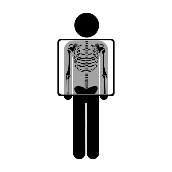 Radiographie thoracique icône image — Image vectorielle