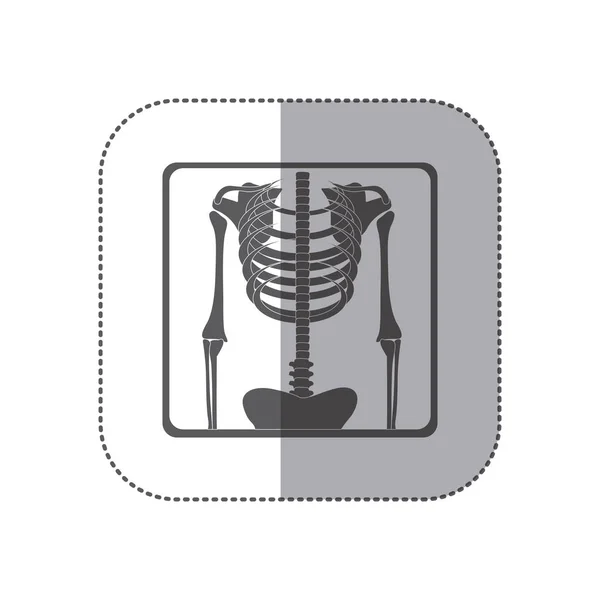 Adesivo monocromatico pittogramma scheletro ossa radiografia — Vettoriale Stock