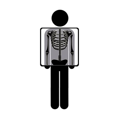 siluet adam onun x-ışını reçete ile
