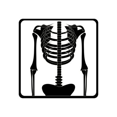 siluet vücut x-ray reçete