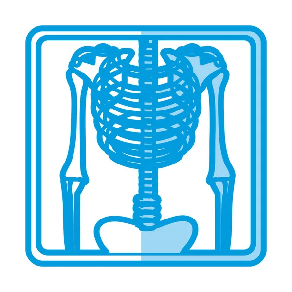 Silhueta de sombreamento azul com raio-x de ossos —  Vetores de Stock