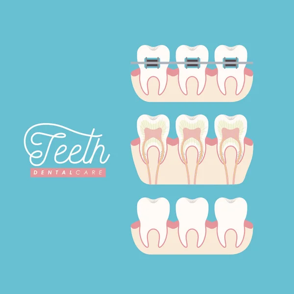 Diş diş bakımı renk poster ayarla — Stok Vektör