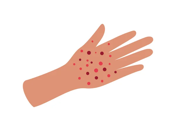 Hand with covid 19 virus vector design — Stock Vector