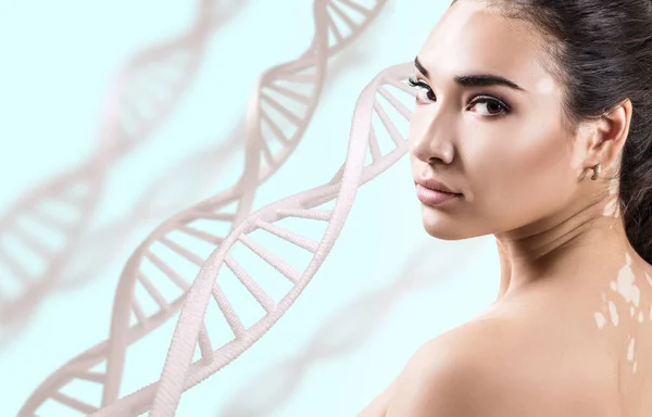 Fiatal érzéki nő vitiligo a DNS láncok — Stock Fotó