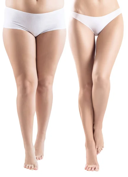 Женские ноги до и после похудения . — стоковое фото