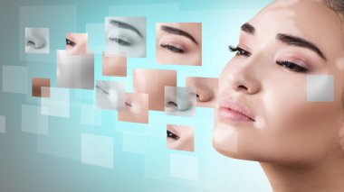 Kadın yüzü vitiligo ile farklı yerlerden toplanmış..