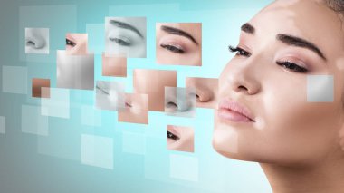 Womans face with vitiligo collected from different parts. clipart