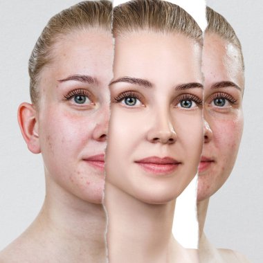 Sivilcelerle ve yeni sağlıklı ciltlerle eski fotoğrafları karşılaştırın..