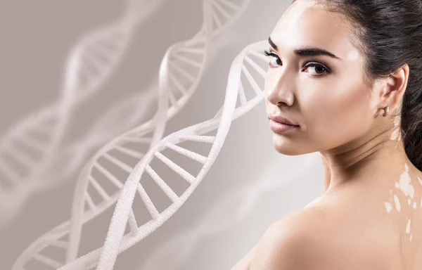 Νεαρή αισθησιακή γυναίκα με λεύκη σε αλυσίδες DNA. — Φωτογραφία Αρχείου
