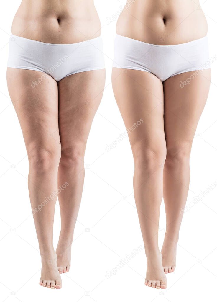 Piernas de mujer antes y después de adelgazar — Foto de stock