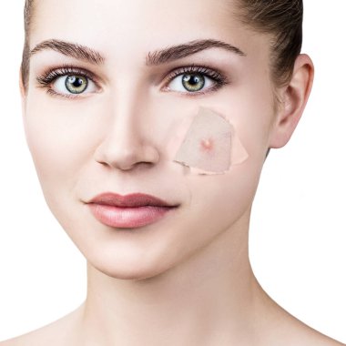 Kadın ile sivilce üzerinde yüz peek gelen delik içinde Vakfı.