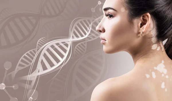 Νεαρή αισθησιακή γυναίκα με λεύκη στις αλυσίδες του DNA — Φωτογραφία Αρχείου