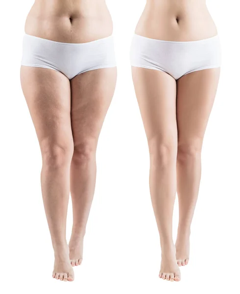 Woman legs before and after slimming. — Stock Photo, Image