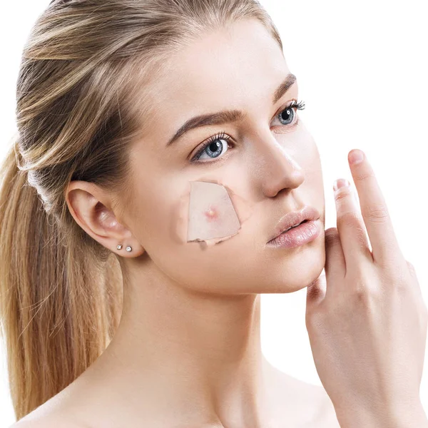 Woman with pimple on face peek from hole in foundation. — Stock Photo, Image