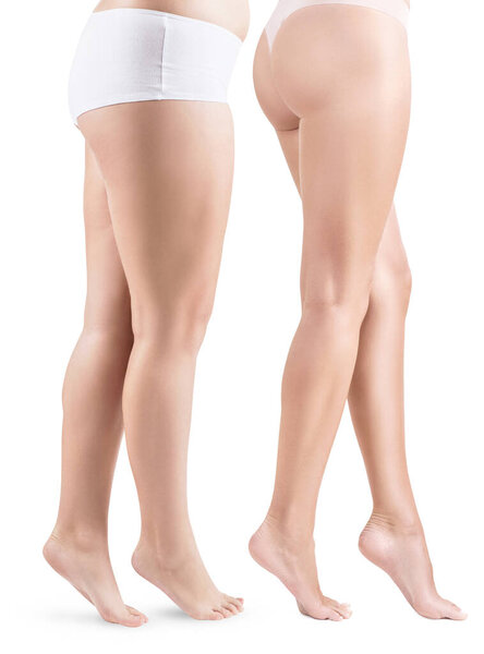 Side view on womans legs before and after slimming.