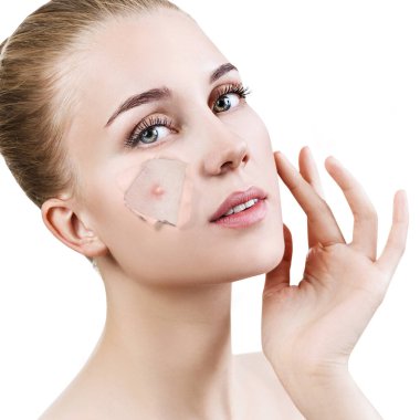 Kadın ile sivilce üzerinde yüz peek gelen delik içinde Vakfı.