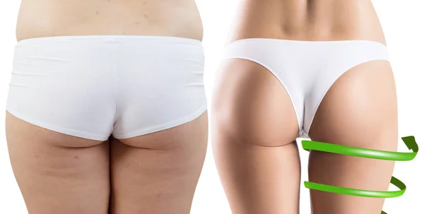 Big spiral arrows shows result of slimming on buttocks. — Stock Photo, Image