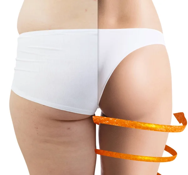 Big spiral arrows shows result of slimming on buttocks. — Stock Photo, Image