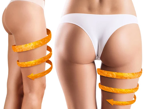 Kvinnliga ben med orange skal pil visar åtstramning effekt. — Stockfoto