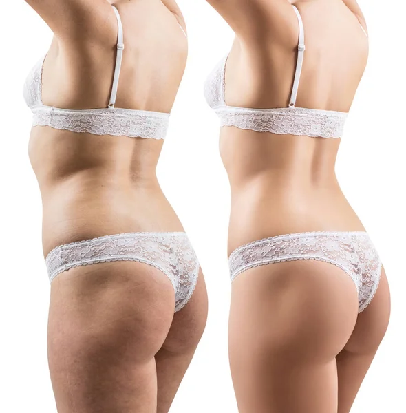 Colagem do corpo feminino antes e depois da perda de peso . — Fotografia de Stock