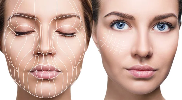 Graphic lines showing facial lifting effect on skin. — Stock Photo, Image